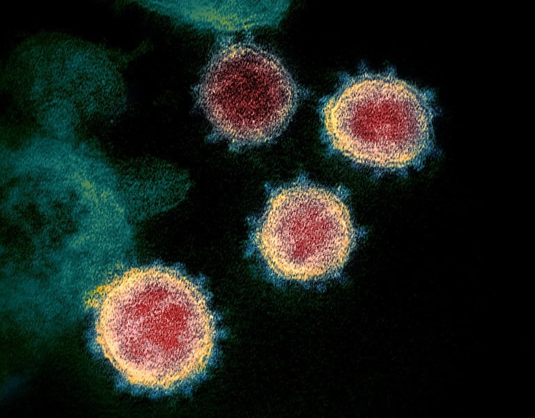 Coronavirus SARS-CoV-2. Imagem: Wikimedia
